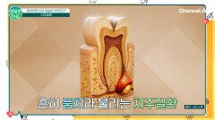 방치하면 치아 상실까지?! 흔히 \