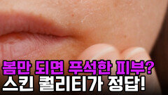 ＂왜 내 피부만 지는 걸까?＂ 봄철 피부 건강 망치는 주범과 해결책 \