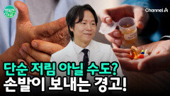 단순한 혈액순환 문제일까? \