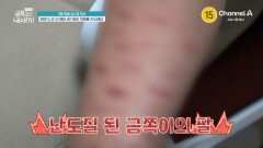 [예고] 엄마 S.O.S! 예비 중1 딸이 자해를 시도해요