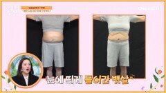 3주 만에 4.8kg 감량 성공?! 반으로 줄어든 염증 수치! 역대급 변화를 보여줬다!
