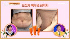 노후된 지방으로 불리는 \
