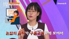 1.5cm 암점이 눈 앞에?! 30대에 찾아온 실명 시그널