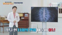 원래 면역력이 약한 체질은 없다!? 면역세포가 약해진 신호가 흰머리?