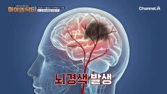 부종을 방치해서 뇌졸중까지!? 조용히 진행되는 뇌혈관에 영향을 미치는 부종