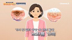 피부 회춘 원하는 중년 여성이라면!? 피부 탄력 향상해 주는 \
