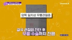 관절염은 내 일상을 무너뜨렸다?! 프로 등산러가 취미생활을 포기한 이유
