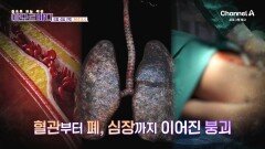 [예고] 혈관부터 폐, 심장까지 이어진 붕괴! 그러다 마주하는 암! 내 몸속 보이지 않는 적을 잡을 방법은?
