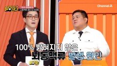 ※터지기 전까지 증상이 없다고?!※ 그것이 궁금하다, 뇌동맥류의 원인과 치료법!