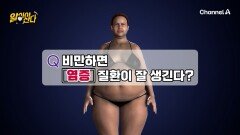 비만하면 잘 생기는 질환이 있다? 체중 증가로 발생하는 염증 질환