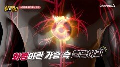 극심한 스트레스! \