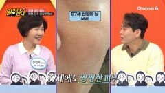 중년 여성의 필수템! 히알루론산으로 주름 타파와 모공 관리까지 한 번에 가능하다?!