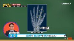 뼈 나이를 알아야 더 클 수 있는지 알 수 있다!?