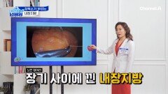 소화불량성 비만, 원인은 장독소! 비만이랑은 무슨 관계일까?