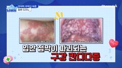 면역력이 떨어지기 좋은 환절기! 면역력이 훅 떨어진다면 어떤 일이 벌어질까?