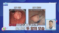 위 건강을 지키면 일석이조! 위와 장은 하나로 연결되어 있다?!