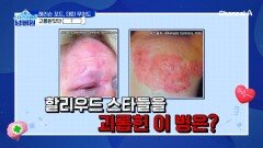 통증의 왕이라 불리는 \