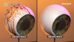 활성산소는 제거하고 시력을 보호한다?! 블루베리 퓨레로 영양 끌어 올려↗