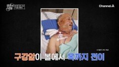 무심코 넘겼던 턱 밑의 혹! 알고 보니 구강암이었다?! 밥도 혼자 먹지 못하는 은달 씨