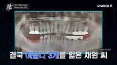 갱년기 이후 심해진 잇몸 통증?! 어금니까지 잃게 된 채원 씨의 사연은?