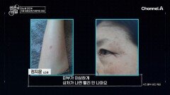 잘못 관리했다간 \