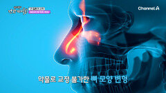 코막힘 증상 원인은 콧속 벽 때문이다?