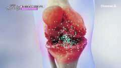 3mm 연골을 사수하라!