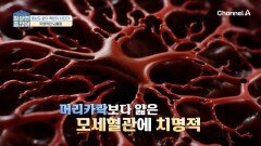 모세혈관이 막히면 '뇌출혈' 위험성까지?! 혈관 건강이 필수적인 이유