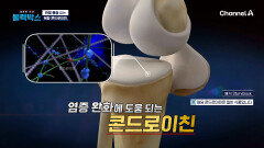 무릎 통증, 단순 노화가 아니다? \