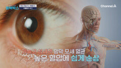 방치한 고혈압이 부른 참사… 실명 위기 \