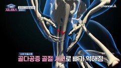 재채기하다가 척추 골절!? 노화로 인해 넘어지지 않아도 척추 골절이 발생할 수 있다