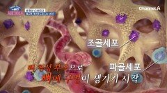 뼈 대사 불균형하면 뼈에 구멍이!? 조골 세포 VS 파골 세포의 불균형 개선에 도움주는 MBP