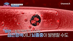 침묵의 살인자 혈관 질환! 전조증상 없는 \