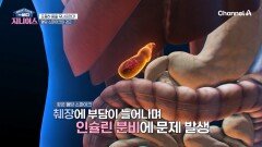 식사 후 쏟아지는 졸음이 혈당 폭주 신호!? 조용히 몸을 무너뜨리는 혈당 스파이크의 경고