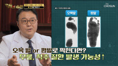 『 발 도장 찍기 』 퇴행성 관절염 자가 진단법🤩 TV CHOSUN 221115 방송