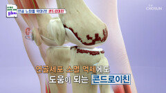 관절 연골의 마모를 감소시키는 데 도움 주는 ‘콘드로이친’ TV CHOSUN 240310 방송