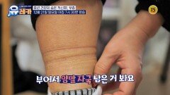 중년 건강의 숨은 적신호!, 부종_내 몸을 살리는 유레카 226회 예고 TV CHOSUN 251221 방송