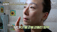 피부 관리를 위해 꼼꼼하게 세안했을 뿐인데🧼 기미 악화의 원인이 됐다?! TV CHOSUN 260524 방송