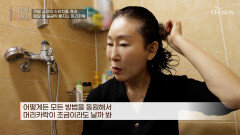 탈모 샴푸부터 두피 마사지까지 아무리 노력해도 붙잡을 수 없는 머리카락 TV CHOSUN 260225 방송