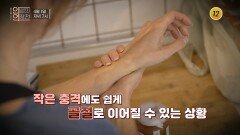 작은 충격에도 뚝! 구멍 난 뼈 채우는 방법_인생의 연장전 185회 예고 TV CHOSUN 260401 방송