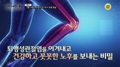 퇴행성관절염을 이겨내고 건강하고 꼿꼿한 노후를 보내는 비밀_더 위대한 유산 70회 예고 TV CHOSUN 240314 방송