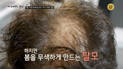 2026 탈모 주의보 헤어(Hair)나고 싶어라!_더 위대한 유산 168회 예고 TV CHOSUN 260416 방송