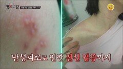 중대한 질병 '만성피로 증후군'_메디컬다큐 명의보감 70회 예고 TV CHOSUN 241108 방송