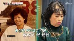 왜 이렇게 빠지는 거야 점점 휑해지는 정수리에 쌓여만 가는 스트레스 TV CHOSUN 260109 방송