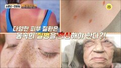 질병 도미노 탈출법! 피부부터 보호하라_소문난 건강법 66회 예고 TV CHOSUN 241109 방송