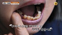 전신 질환의 씨앗! 입속 염증을 잡아라!_소문난 건강법 107회 예고 TV CHOSUN 251108 방송