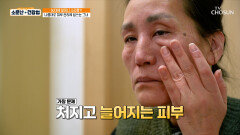 아직 50대인데 깊은 주름과 처진 피부 때문에 할머니 소리 듣는 주인공 TV CHOSUN 260110 방송