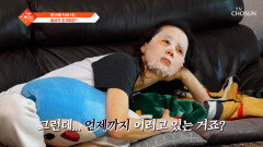 오래 붙이고 있던 마스크팩이 피부를 망친다 피부 고민과 이별하는 방법 TV CHOSUN 260414 방송