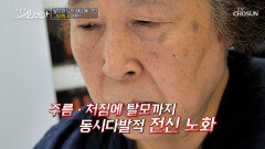 탱탱한 피부를 원해 전신 노화에 시달리고 있는 주인공 TV CHOSUN 260531 방송