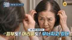 피부와 모발 고민 한 번에 잡는 방법!_나이야가라 44회 예고 TV CHOSUN 260508 방송